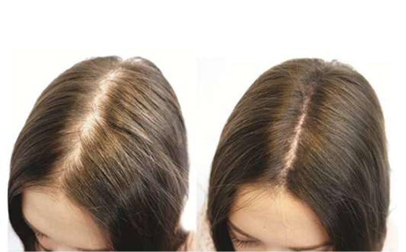 Chăm sóc tóc với tinh dầu nuôi dưỡng tóc Lam Hà