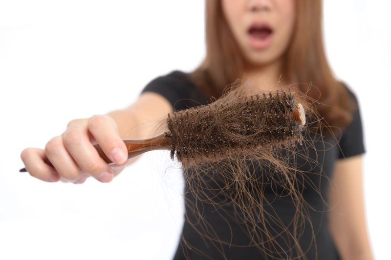 Dứt điểm tình trạng rụng tóc - nội ngoại kết hợp