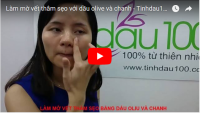 [VIDEO] Làm mờ vết thâm sẹo với dầu olive và chanh