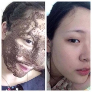 Trắng da - khử độc - sạch mụn - ngừa thâm