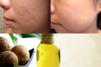 Công dụng thần kỳ của dầu mù u