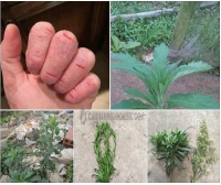 Được anh khách chia sẻ cảm nhận khi sử dụng tinh dầu ngải cứu giúp cải thiện viêm da cơ địa tại shop tinh dầu 100.