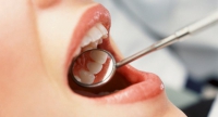 CHẢY MÁU CHÂN RĂNG – BIỂU HIỆN BAN ĐẦU CỦA NHIỀU BỆNH LÝ Ở CHÂN RĂNG