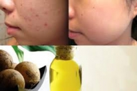 Một số công dụng và cách dùng của dầu mù u
