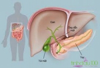 Đá nóng chườm gan - xua tan mỡ máu