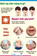 Cảnh báo dịch Tay Chân Miệng đã bùng phát trở lại