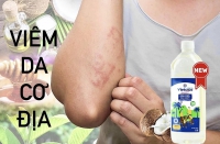 VIÊM DA CƠ ĐỊA CÓ SỬ DỤNG ĐƯỢC DẦU DỪA HAY KHÔNG ?