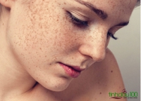 5 phương pháp đơn giản nhất giúp làm mờ nám và tàn nhang tại nhà: