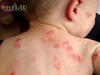 Bí kíp để gián/kiến/kiến 3 khoang/bọ chó mèo tránh xa bé yêu của bạn