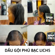 Mái tóc bạc khiến bạn mất tự tin ư? Đây là giải pháp chúng tôi dành tặng bạn!