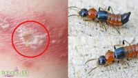 Giải pháp nào cho vấn đề gián/kiến/kiến 3 khoang/bọ chó mèo?