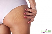 Gợi ý cho chị em cách chăm sóc cơ thể với dầu massage gừng