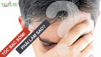 Cách phục hồi và hạn chế tóc bạc sớm hiệu quả