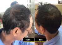 Sử dụng dầu gội hà thủ ô có tốt không??