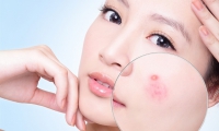 Rửa sữa rửa mặt đem lại lợi ích gì cho da??