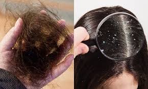 Nguyên nhân và biểu hiện khi tóc hư tổn  Nguyên Xuân